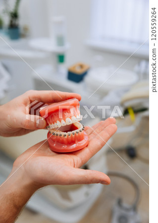 Hand displaying orthodontic teeth model with braces for dental education and oral health care Hand displaying orthodontic teeth model with braces for dental education and oral health care 120559264