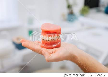 Hand holding orthodontic model with braces, showcasing dental care and orthodontic treatment Hand holding orthodontic model with braces, showcasing dental care and orthodontic treatment 120559267
