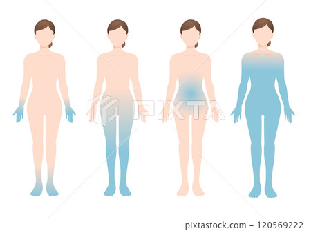 Illustrations of four different realistic body types of women with poor circulation 120569222
