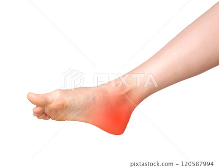 Heel pain, joint inflammation from arthritis or neuropathy. Inflamed feet with numbness, callus, or Heel pain, joint inflammation from arthritis or neuropathy. Inflamed feet with numbness, callus, or 120587994