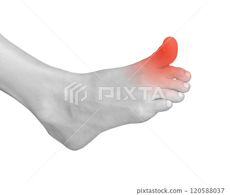 Big toe pain, foot contusion from strain or injury. Sore, tensed joints with neuropathy or arthritis Big toe pain, foot contusion from strain or injury. Sore, tensed joints with neuropathy or arthritis 120588037