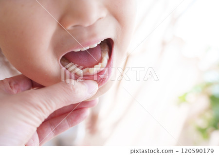 A child's mouth with misaligned teeth 120590179