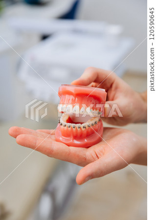 Hand displaying orthodontic teeth model with braces for dental education and oral health care 120590645
