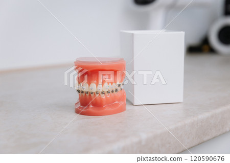 Orthodontic dental model with braces for patient education and treatment planning display Orthodontic dental model with braces for patient education and treatment planning display 120590676
