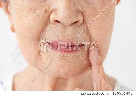 Senior woman mouth nasolabial folds 120595448