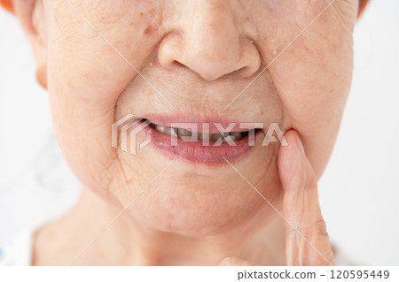Senior woman mouth nasolabial folds Senior woman mouth nasolabial folds 120595449