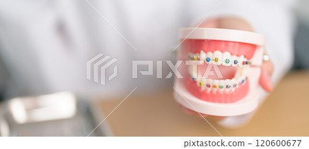 Dentist with Orthodontic tooth model and bracket or brace. Clean and Scrape off tartar. May Orthodontic Health Day, March Oral health, Dentist Day, False Teeth. Toothache and Children Dental Health 120600677