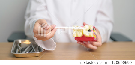 Dentist with tooth Anatomy model. Oral Teeth decay and disease, Scrape off tartar. March Oral health, Dentist Day, False Teeth. Toothache and Children Dental Health Month and Orthodontic Health Day 120600690