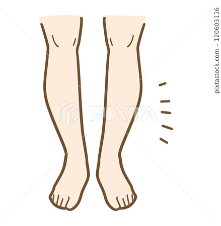 女人的羅圈腿的插圖 120603116