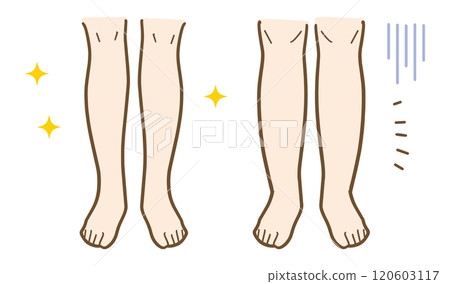 Illustration of slim and thick female legs Illustration of slim and thick female legs 120603117