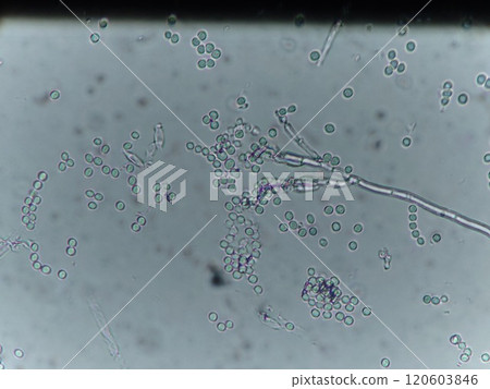 Micrograph of unstained Penicillium sp. 120603846