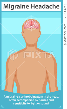 Understanding Migraine Headaches 120633746