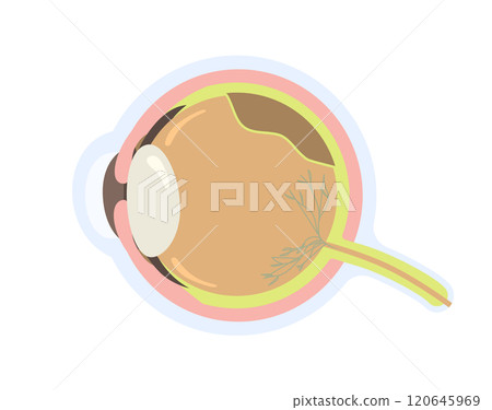 Eye With Retinal Detachment Vector Illustration 120645969