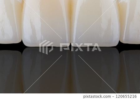 High-quality naturally dental single crowns made of zirconia and stained like old man teeth. 120655216