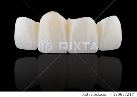 High-quality naturally dental single crowns made of zirconia and stained like old man teeth. 120655217