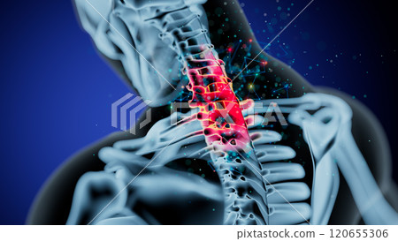 Highlighting Cervical Injury: A Digital Representation of the Human Spine Highlighting Cervical Injury: A Digital Representation of the Human Spine 120655306