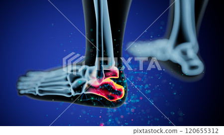 Anatomical Illustration of Ankle Joint with Inflammation Highlight 120655312