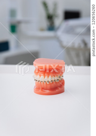 Orthodontic model with braces showcasing dental care and orthodontic treatment in a modern clinic Orthodontic model with braces showcasing dental care and orthodontic treatment in a modern clinic 120656260