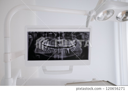 Dental Xray image displayed on a monitor in a modern clinic, highlighting oral health diagnostics 120656271