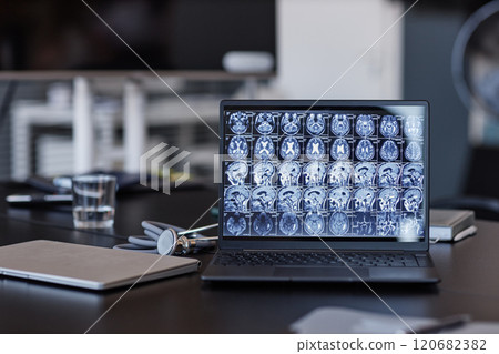 Background shot of neurologists laptop displaying X ray scan imaging of patients brain on screen on meeting table in medical office, copy space Background shot of neurologists laptop displaying X ray scan imaging of patients brain on screen on meeting table in medical office, copy space 120682382