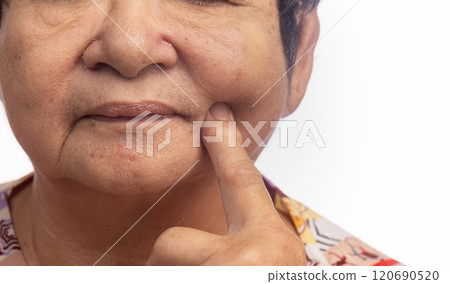 Flabby and wrinkled skin on senior woman face. Flabby and wrinkled skin on senior woman face. 120690520