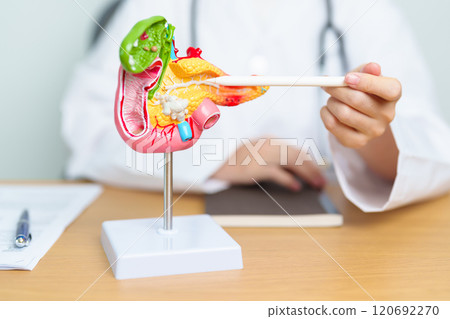 Doctor with human Pancreatitis anatomy model with Pancreas, Gallbladder, Bile Duct, Duodenum, Small intestine and tablet. Pancreatic cancer, acute pancreatitis and Digestive system 120692270