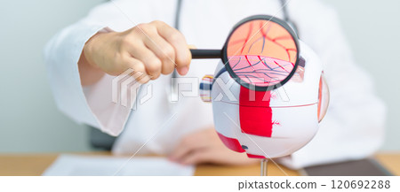 Doctor with human Eye anatomy model with magnifying glass. Eye disease, Refractive Errors, Age Related Macular Degeneration, Cataract, Diabetic Retinopathy, Glaucoma, Amblyopia, Strabismus and Health Doctor with human Eye anatomy model with magnifying glass. Eye disease, Refractive Errors, Age Related Macular Degeneration, Cataract, Diabetic Retinopathy, Glaucoma, Amblyopia, Strabismus and Health 120692288