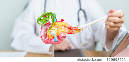 Doctor with human Pancreatitis anatomy model with Pancreas, Gallbladder, Bile Duct, Duodenum, Small intestine and tablet. Pancreatic cancer, acute pancreatitis and Digestive system 120692321