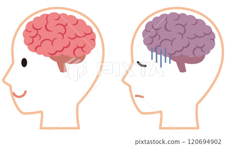 Healthy brain and stressed brain Brain image Health Healthy brain and stressed brain Brain image Health 120694902