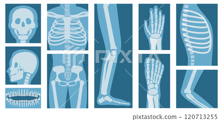 3D Isometric Flat Set of XRay Of Human Body Parts, Skeleton and Bones Scan 3D Isometric Flat Set of XRay Of Human Body Parts, Skeleton and Bones Scan 120713255