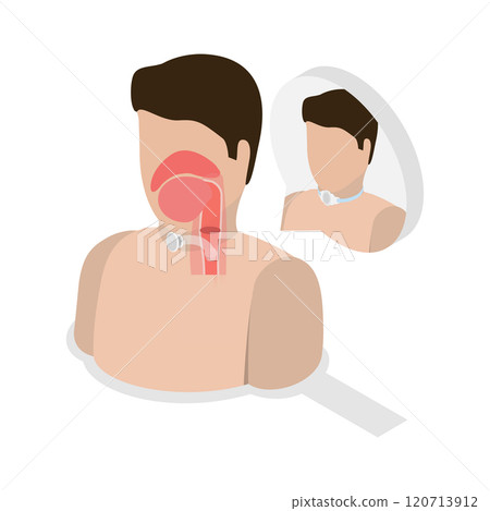 3D Isometric Flat Illustration of Tracheostomy, Tracheal Surgery 3D Isometric Flat Illustration of Tracheostomy, Tracheal Surgery 120713912