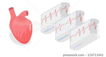 3D Isometric Flat  Illustration of Pathological Heart Rhythm Types, Electro-cardiogram 120713942