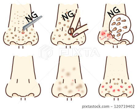 Nostril NG care, Beautiful nose, Troubled nose 120719402