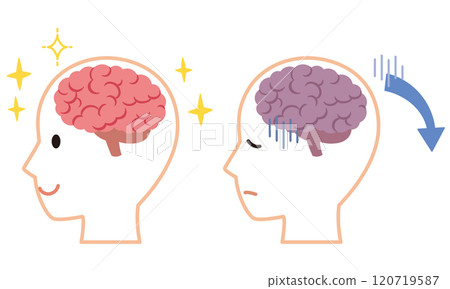 Healthy brain and stressed brain Brain image Health Healthy brain and stressed brain Brain image Health 120719587