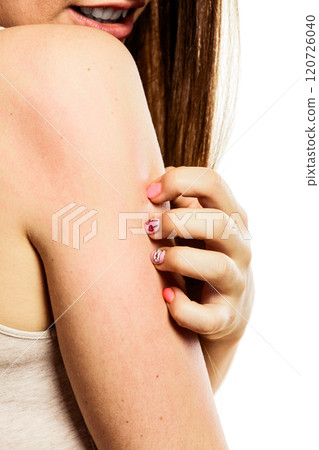 Woman scratching her arm 120726040