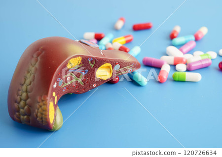 Liver model with pill drug treatment, Cirrhosis, Liver cancer, fatty liver. 120726634
