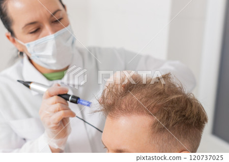 Trichologist doing man improve hair growth procedure, dermapen microneedling, vitamin injections Trichologist doing man improve hair growth procedure, dermapen microneedling, vitamin injections 120737025