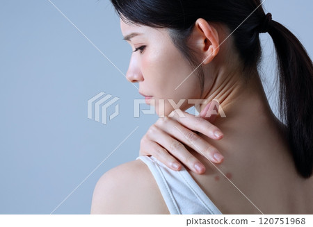Image of a woman suffering from back acne 120751968