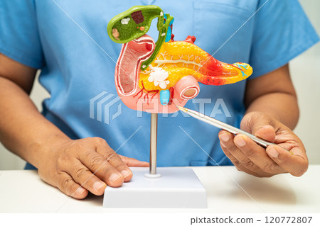 Pancreatitis, pancreatic cancer, Asian doctor with pancreas, gallbladder and bile duct human anatomy model at hospital. 120772807