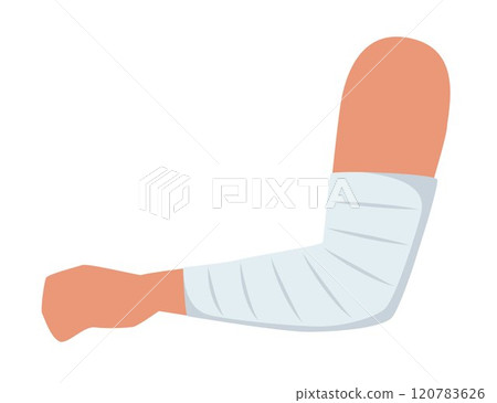 Bandaged arm. Medical elastic bandage. Element of health care, first aid. Vector illustration. Bandaged arm. Medical elastic bandage. Element of health care, first aid. Vector illustration. 120783626
