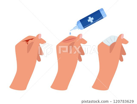 Bleeding cut on the palm, emergency situation. First aid treatment for wound on skin. Trauma, treatment procedure. Vector illustration. 120783629