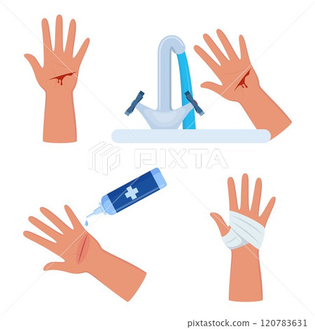 Bleeding cut on the palm, emergency situation. First aid treatment for wound on skin. Trauma, treatment procedure. Vector illustration. 120783631