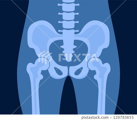 XRay of hip joint pelvis human bones anatomy orthopedic medical diagnostic. X ray roentgen radiology shot surgery femur healthy skeleton spine anatomical structure image. Vector illustration. 120783655