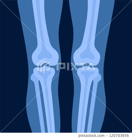 Xray of human knees bones and joints, examination and diagnosis. Healthcare and rheumatism analysis, physical care in hospital or clinics. Vector illustration. Xray of human knees bones and joints, examination and diagnosis. Healthcare and rheumatism analysis, physical care in hospital or clinics. Vector illustration. 120783656