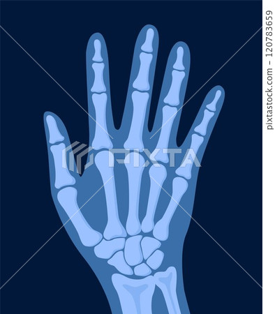 X ray human hand. Body bone roentgen front view. Medical anatomy. Arm checking healthcare joint palm finger exam. Radiology scan MRI hospital traumatology. Vector illustration 120783659