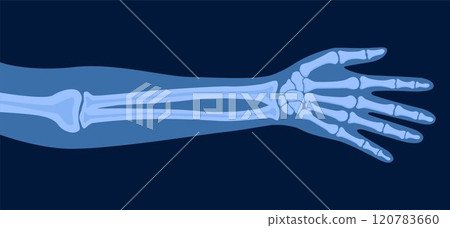 X ray human hand. Body bone roentgen front view. Medical anatomy. Arm checking healthcare joint palm finger exam. Radiology scan MRI hospital traumatology. Vector illustration 120783660