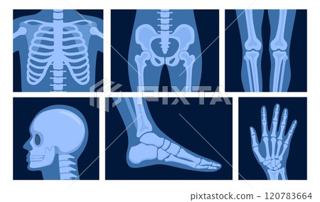 Different x-rays shot of human body part, set. Various x-ray pictures of head, hand, foot, leg, torso, chest and pelvis. Vector illustration. Different x-rays shot of human body part, set. Various x-ray pictures of head, hand, foot, leg, torso, chest and pelvis. Vector illustration. 120783664