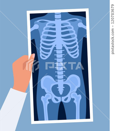 Human skeleton chest x ray image. Torso roentgen shot. Medical analyzing. Anatomical bone medicine laboratory radial scan picture. Roentgen shot in doctors hand. Vector illustration. 120783679
