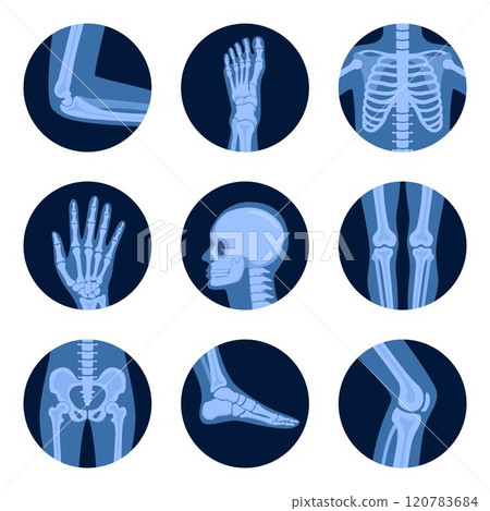 Parts of human body on x ray view. Different x-rays shot of human body part, set. Various x-ray pictures of head, hand, foot, leg, torso, chest and pelvis. Vector illustration. Parts of human body on x ray view. Different x-rays shot of human body part, set. Various x-ray pictures of head, hand, foot, leg, torso, chest and pelvis. Vector illustration. 120783684