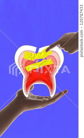 Contemporary art collage. Cracked tooth with yellow tape and hands pointing at it, symbolizing dental problems and repair. against blue background. 120787433